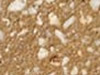 Sand blasted concrete